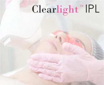 Особенности процедуры на аппарате CLEARLIGHT IPL